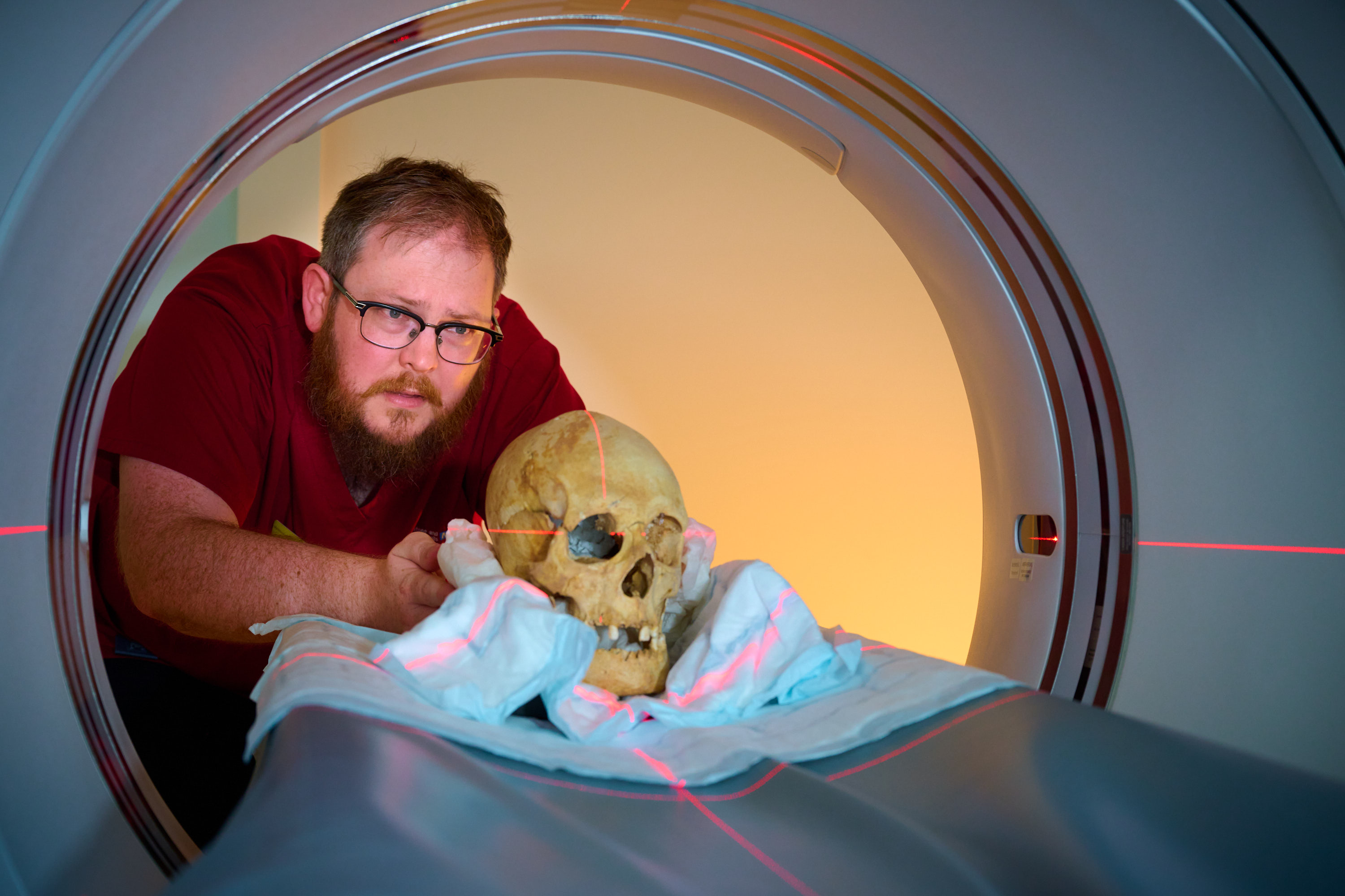Mystery skull undergoes scan